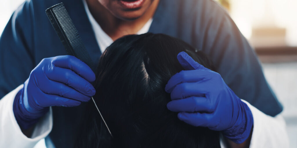 produtos para prevenir a queda do cabelo